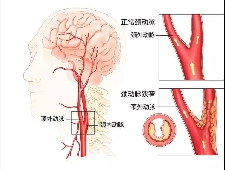 图片11.png